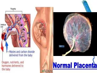 Normal Placenta