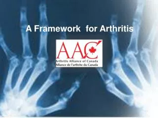 A Framework for Arthritis