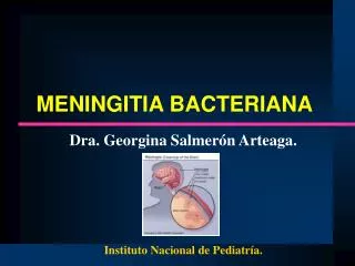 meningitia bacteriana