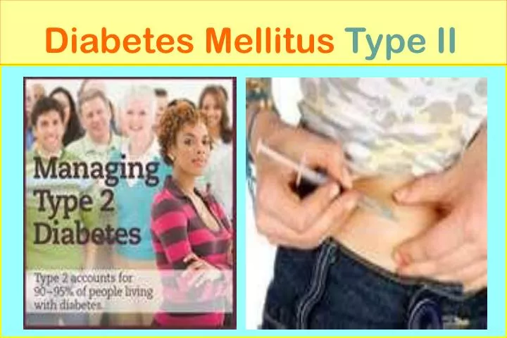 diabetes mellitus type ii