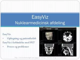 easyviz nuklearmedicinsk afdeling