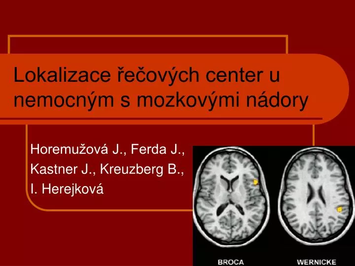 lokalizace e ov ch center u nemocn m s mozkov mi n dory