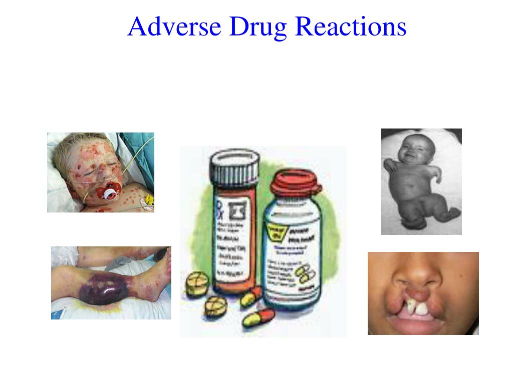 PPT - Adverse Drug Reactions PowerPoint Presentation, free download ...