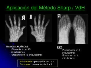 aplicaci n del m todo sharp vdh