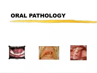 ORAL PATHOLOGY