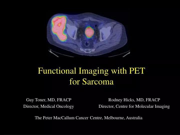 functional imaging with pet for sarcoma