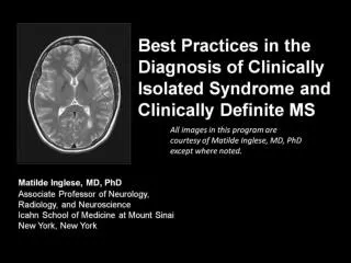 Best Practices in the Diagnosis of Clinically Isolated Syndrome and Clinically Definite MS