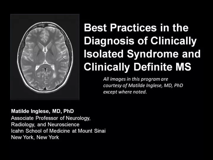 best practices in the diagnosis of clinically isolated syndrome and clinically definite ms
