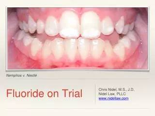 Fluoride on Trial