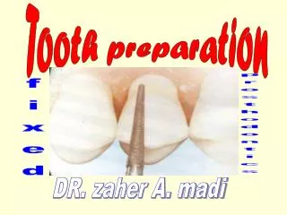 Tooth preparation