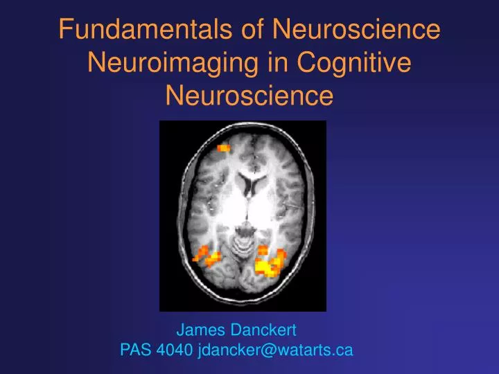 fundamentals of neuroscience neuroimaging in cognitive neuroscience