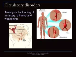Circulatory disorders
