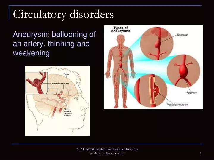 circulatory disorders