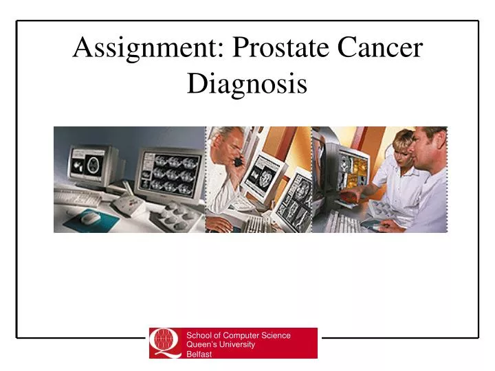 assignment prostate cancer diagnosis