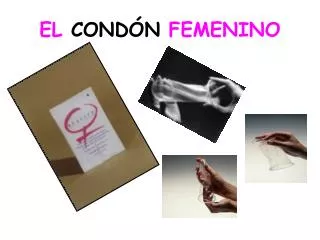 EL CONDÓN FEMENINO