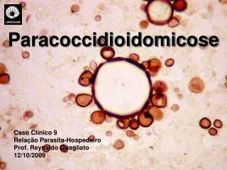 Paracoccidioidomicose