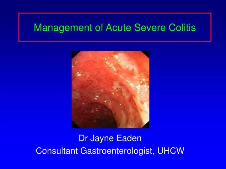 management of acute severe colitis