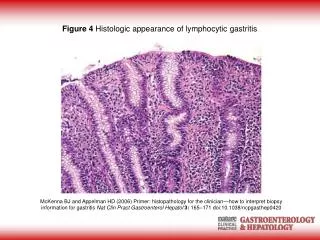 Figure 4 Histologic appearance of lymphocytic gastritis