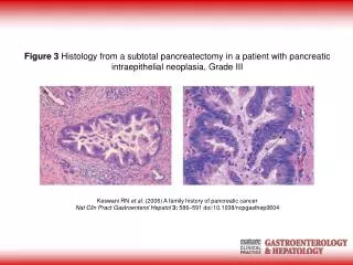 Keswani RN et al. (2006) A family history of pancreatic cancer
