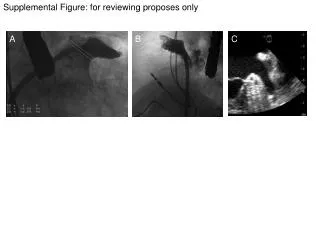 Supplemental Figure : for reviewing proposes only