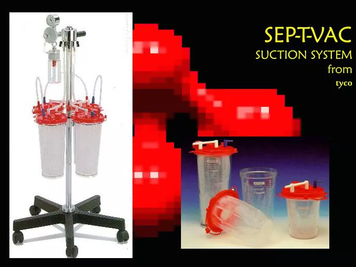 sep t vac suction system from tyco