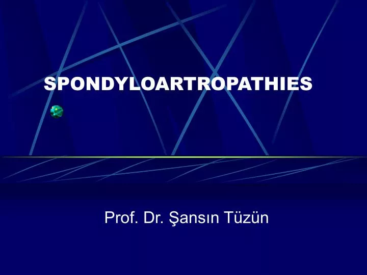 spondyloartropathies