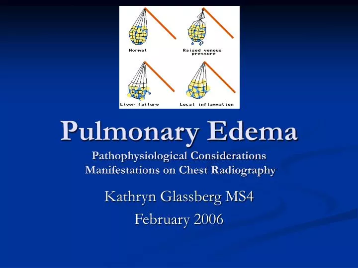 pulmonary edema pathophysiological considerations manifestations on chest radiography