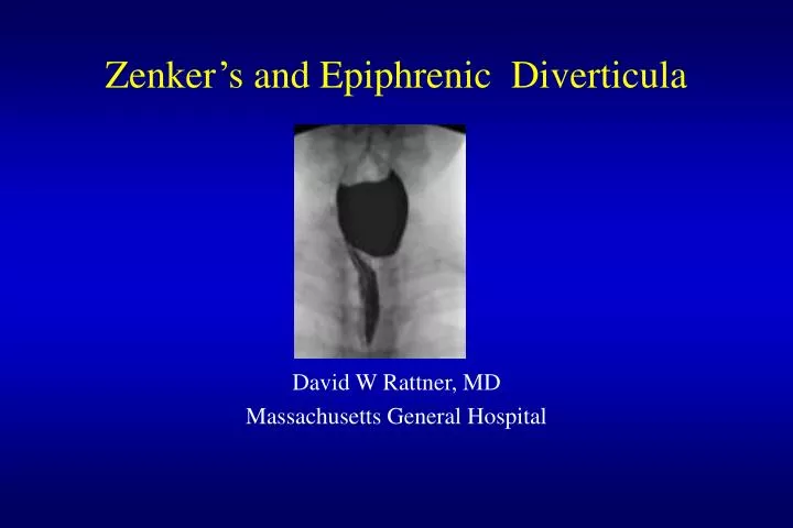 zenker s and epiphrenic diverticula