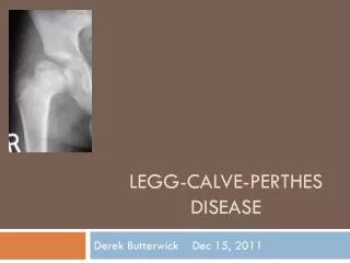 LegG -Calve- Perthes Disease