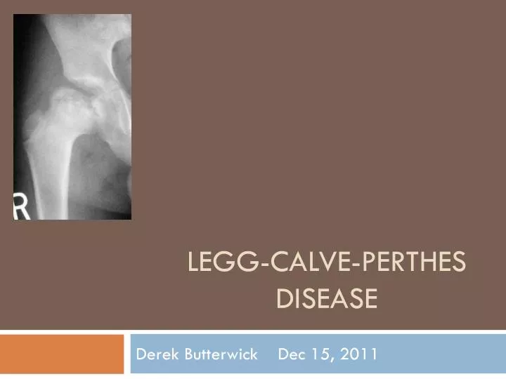 legg calve perthes disease