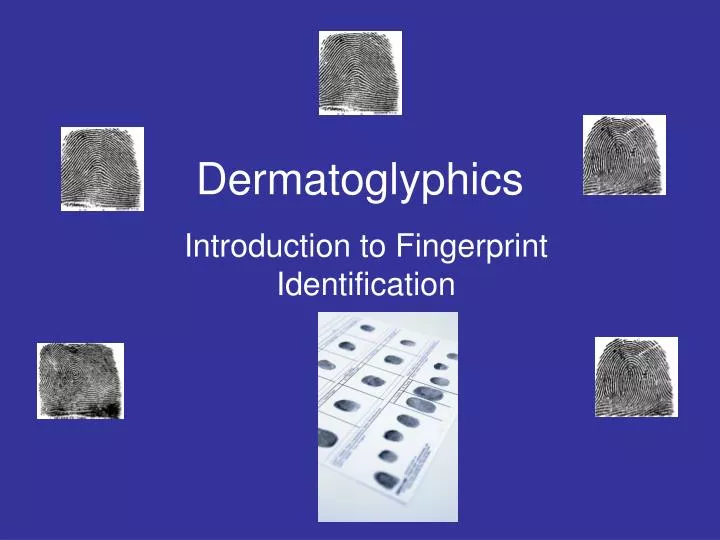 dermatoglyphics