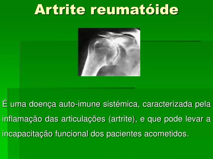 artrite reumat ide