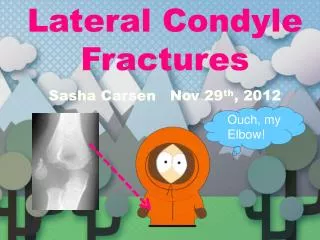 Lateral Condyle Fractures Sasha Carsen Nov 29 th , 2012