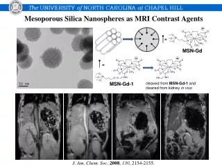 Mesoporous Silica Nanospheres as MRI Contrast Agents