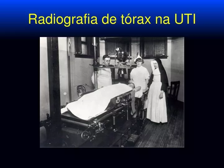radiografia de t rax na uti