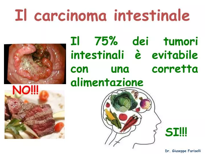 il carcinoma intestinale
