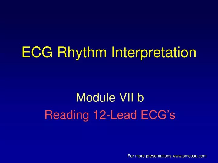 ecg rhythm interpretation