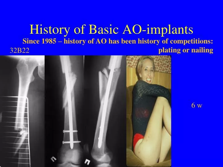 history of basic ao implants