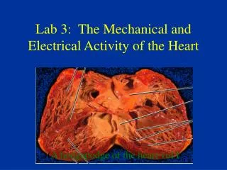 Lab 3: The Mechanical and Electrical Activity of the Heart