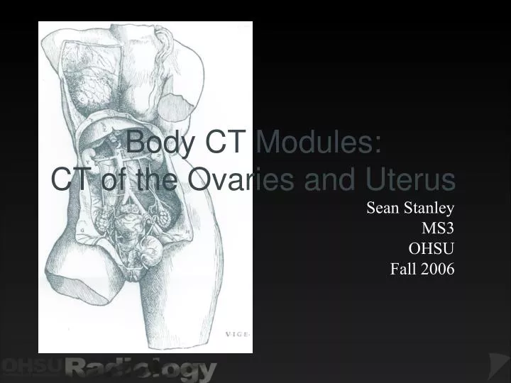 body ct modules ct of the ovaries and uterus