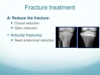 Fracture treatment