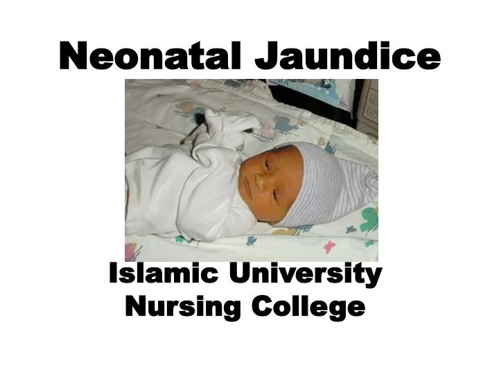 neonatal jaundice islamic university nursing college