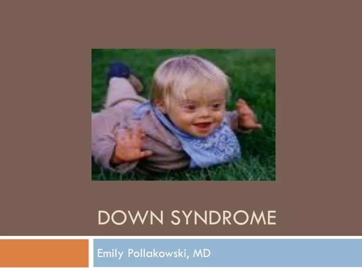 PPT - DOWN SYNDROME PowerPoint Presentation, free download - ID:5879942