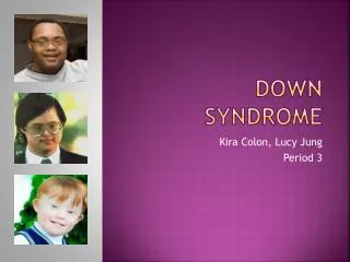 Down Syndrome