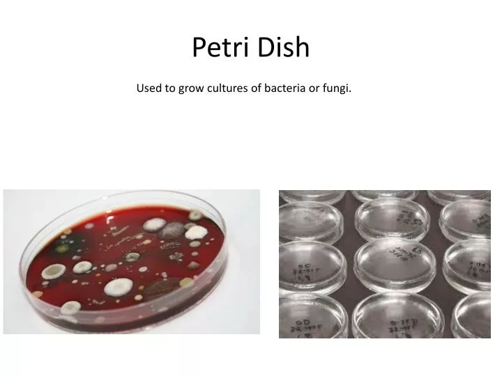 petri dish