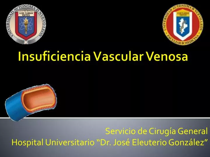 insuficiencia vascular venosa