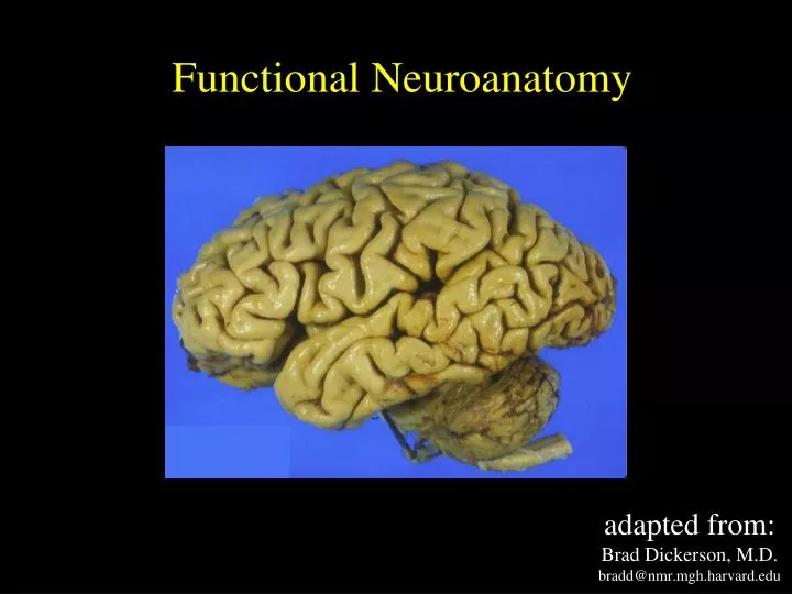 adapted from brad dickerson m d bradd@nmr mgh harvard edu