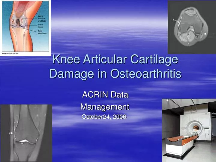 knee articular cartilage damage in osteoarthritis