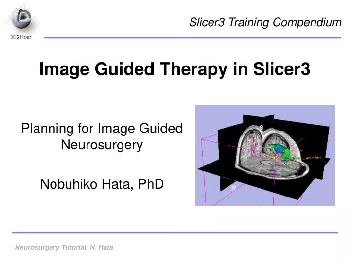 image guided therapy in slicer3