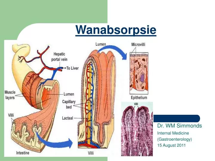 wanabsorpsie